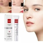 Youbuy Whitening Blemish Whitening Freckle Cream